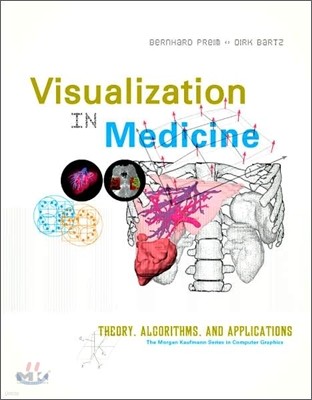 Visualization in Medicine