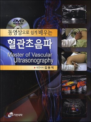 혈관초음파