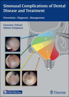 Sinonasal Complications of Dental Disease and Treatment: Prevention - Diagnosis - Management