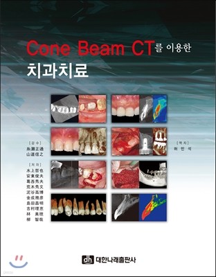 Cone Beam CT를 이용한 치과치료 