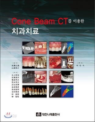 Cone Beam CT를 이용한 치과치료