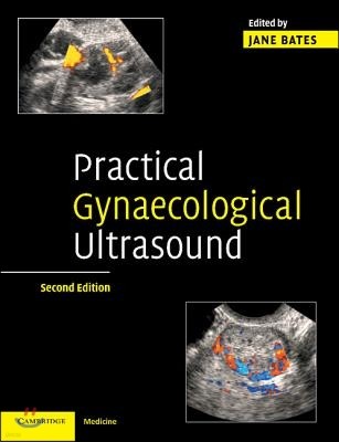 Practical Gynaecological Ultrasound