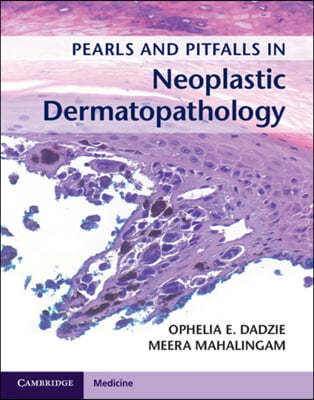 Pearls and Pitfalls in Neoplastic Dermatopathology with Online Access