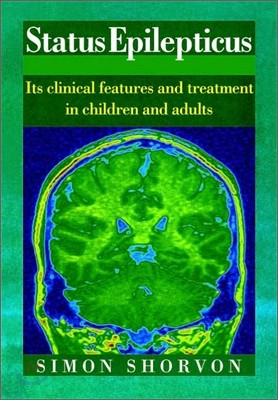 Status Epilepticus