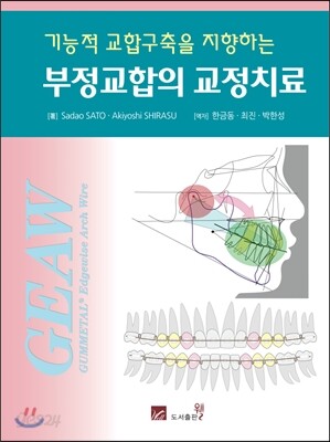 부정교합의 교정치료