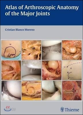 Atlas of Arthroscopic Anatomy of the Major Joints