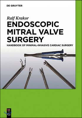 Endoscopic Mitral Valve Surgery: Handbook of Minimal-Invasive Cardiac Surgery