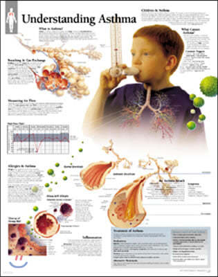 Understanding Asthma Paper Poster