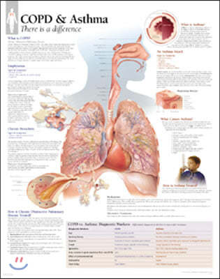 Copd/asthma, Laminated Chart