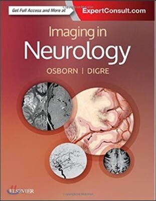 Imaging in Neurology