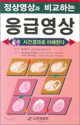 정상영상과 비교하는 응급영상