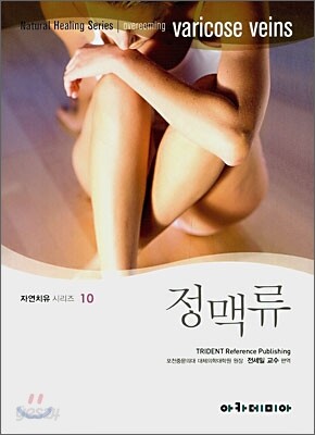 정맥류