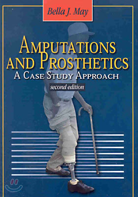 Amputations and Prosthetic