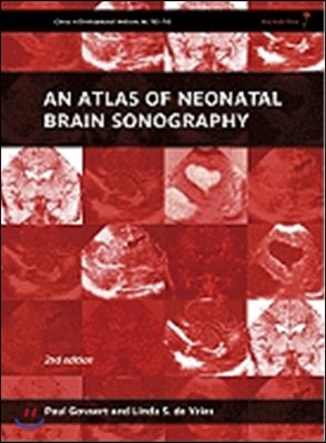 An Atlas of Neonatal Brain Sonography