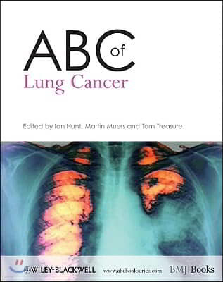 ABC of Lung Cancer