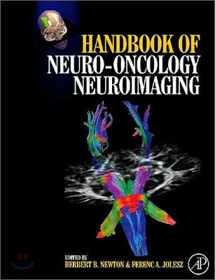 Handbook of Neuro-Oncology Neuroimaging