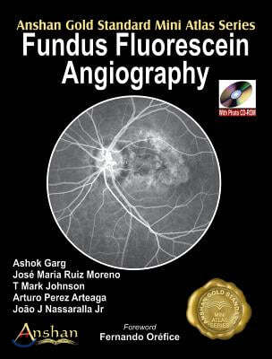 Fundus Fluorescein Angiography [With Mini CDROM]