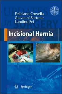 Incisional Hernia