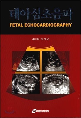 태아심초음파