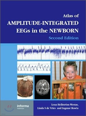 Atlas of Amplitude-Integrated EEGs in the Newborn