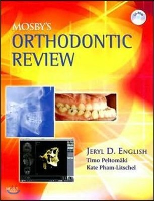 Mosby's Orthodontic Review