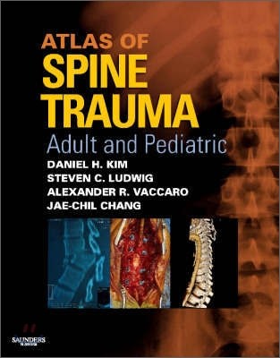 Atlas of Spine Trauma
