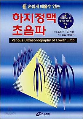하지정맥초음파