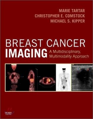 Breast Cancer Imaging