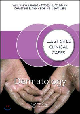 Dermatology