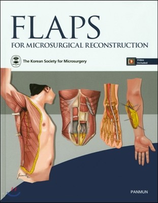 FLAPS for Microsurgical Reconstruction