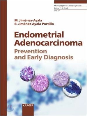 Endometrial Adenocarcinoma