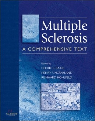 Multiple Sclerosis