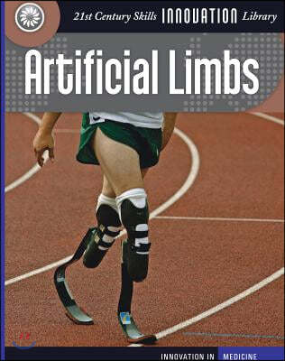 Artificial Limbs