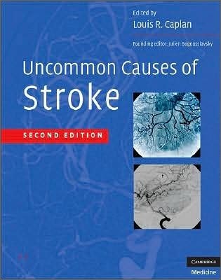 Uncommon Causes of Stroke