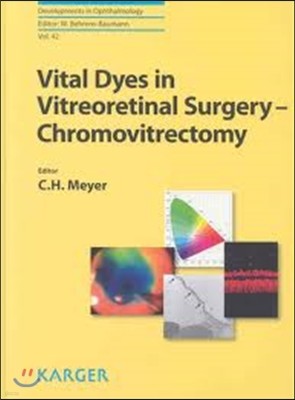 Vital Dyes in Vitreoretinal Surgery