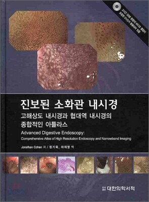 진보된 소화관 내시경