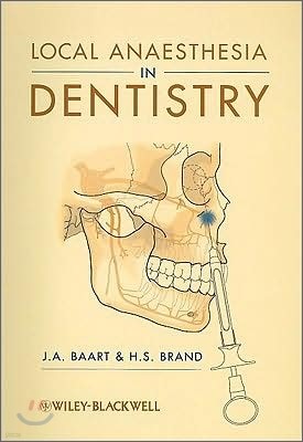 Local Anaesthesia in Dentistry