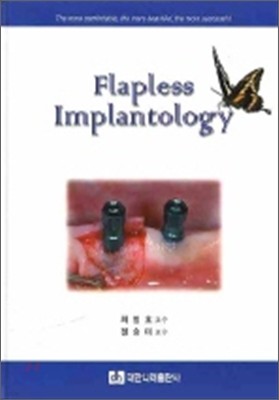 FLAPLESS IMPLANTOLOGY