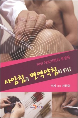 사암침과 면역약침의 만남