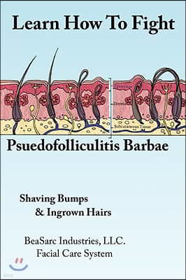 Learn How To Fight Psuedofolliculitis Barbae: Shaving Bumps & Ingrown Hairs