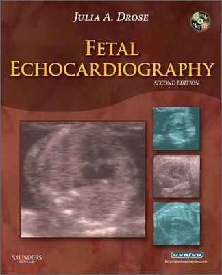 Fetal Echocardiography, 2/E