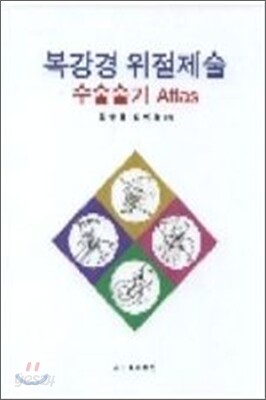 복강경 위절제술 수술술기 Atlas