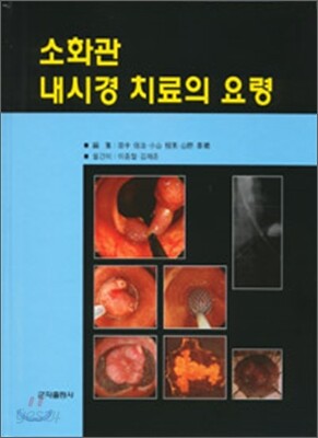 소화관 내시경 치료의 요령