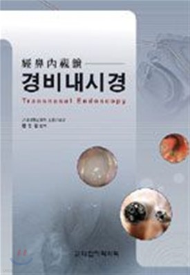 񳻽ð Transnasal Endoscopy