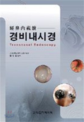 경비내시경 Transnasal Endoscopy