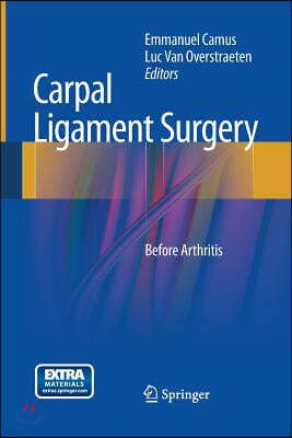 Carpal Ligament Surgery: Before Arthritis