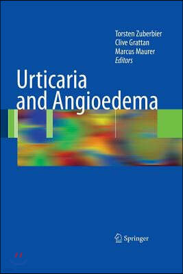 Urticaria and Angioedema