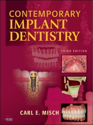 Contemporary Implant Dentistry, 3/E