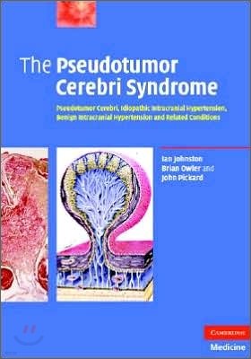 The Pseudotumor Cerebri Syndrome