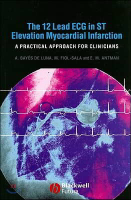 The 12-Lead ECG in ST Elevation Myocardial Infarction: A Practical Approach for Clinicians